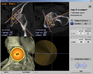 CT based Navigation3