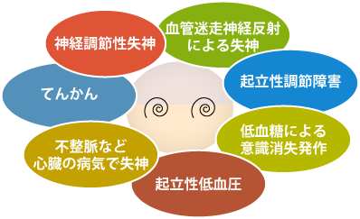 意識消失発作が起こり得る様々な原因のイメージ画像