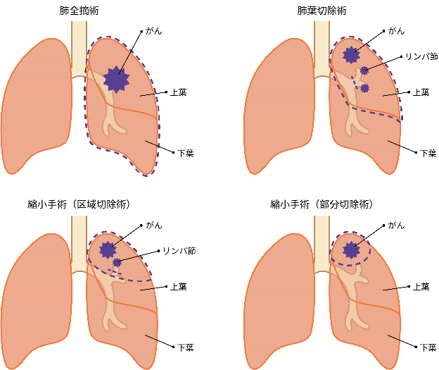 上記の説明を図で表したイラスト。